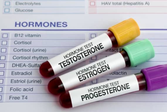 Hormonal imbalance test for estrogen, testosterone and progesterone